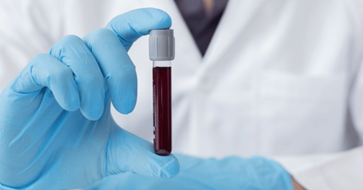 Bientôt, un simple test sanguin pourrait déterminer notre risque de démence